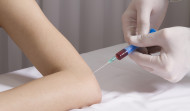 PRP treatment uses your own blood. Find out more about the PRP Procedure